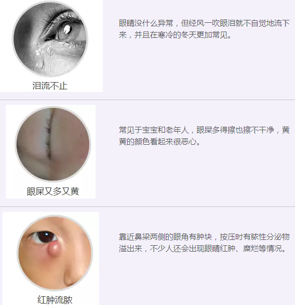 12月17日，普瑞集團(tuán)淚道專家來疆親診，預(yù)約請(qǐng)速！